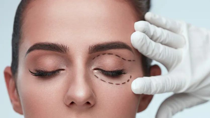 Eyelid Surgery